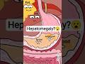 what are causes of hepatomegaly? 😭 लीवर में सूजन.