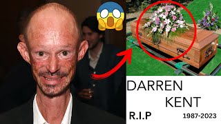 LAST WORDS: Darren kent Cause of Death? Game of Thrones Star, Dead at 39