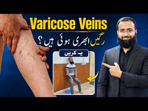 Varicose Veins Are Warning You | These Exercises Help Wake Up Lazy Blood Circulation in the Legs