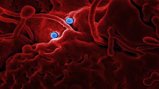 Public health officials report Florida's first 2 COVID-19 deaths