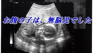 【涙腺崩壊】お腹の子は、無脳児でした。 泣ける話