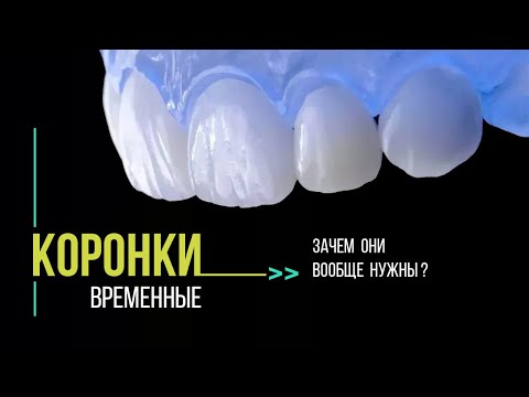 А нужны ли временные коронки на зубы❓