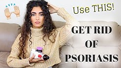 HOW TO GET RID OF PSORIASIS.. SERIOUSLY!