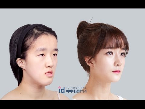 Let Me In Vietsub Phẫu Thuật Thẩm Mỹ Han Quốc Phần 6 Youtube