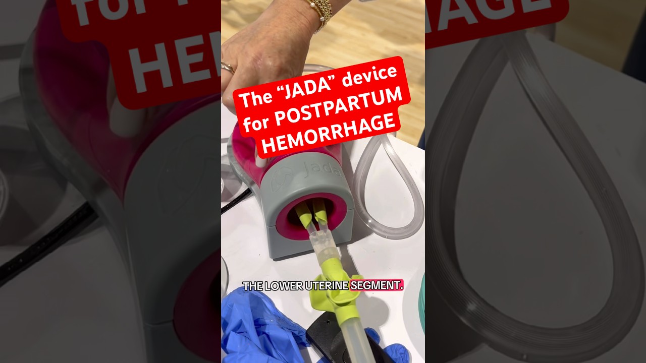 Thumbnail for The Jada!!! For postpartum hemorrhage! #Pregnancy #Birth #Nurse #Mom