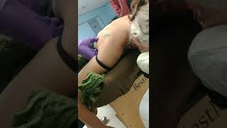 Orthopedic Trigger Point Acupuncture: Dry Needling & Chinese Medicine - Teres Minor / Major