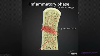 Bone Fracture and Pathology Compilation