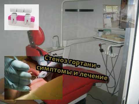 Стеноз гортани - симптомы и лечение