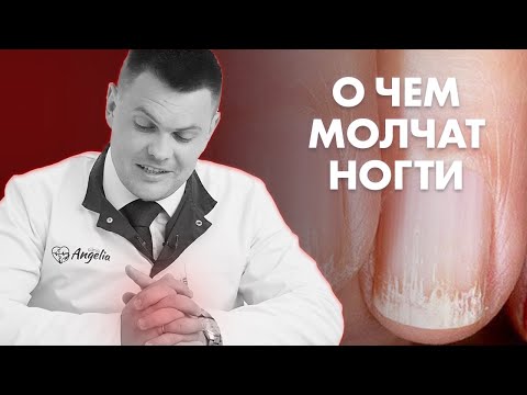 ОБРАТИ ВНИМАНИЕ НА СВОИ НОГТИ | Клиника Online