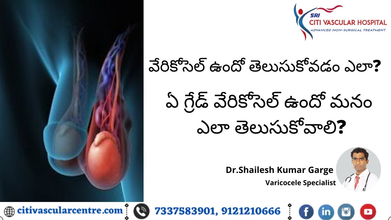 Varicocele Grading In Telugu Varicocele Stages Simple And Easy Top Varicocele Grading In Telugu Varicocele Stages Simple And Easy Top