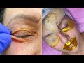 Most Extreme Beauty Treatments 2021 Best Smart and Helpful Beauty Hacks | Virtual Beauty