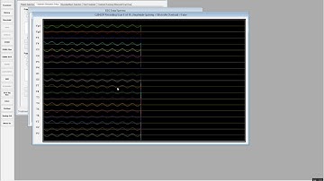 NeuroField64 19 Channel Acquire to EDF