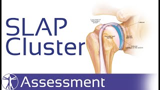 Test Cluster for the Long Head of the Biceps | SLAP Lesions