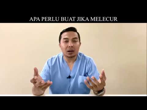 APA PERLU BUAT JIKA MELECUR