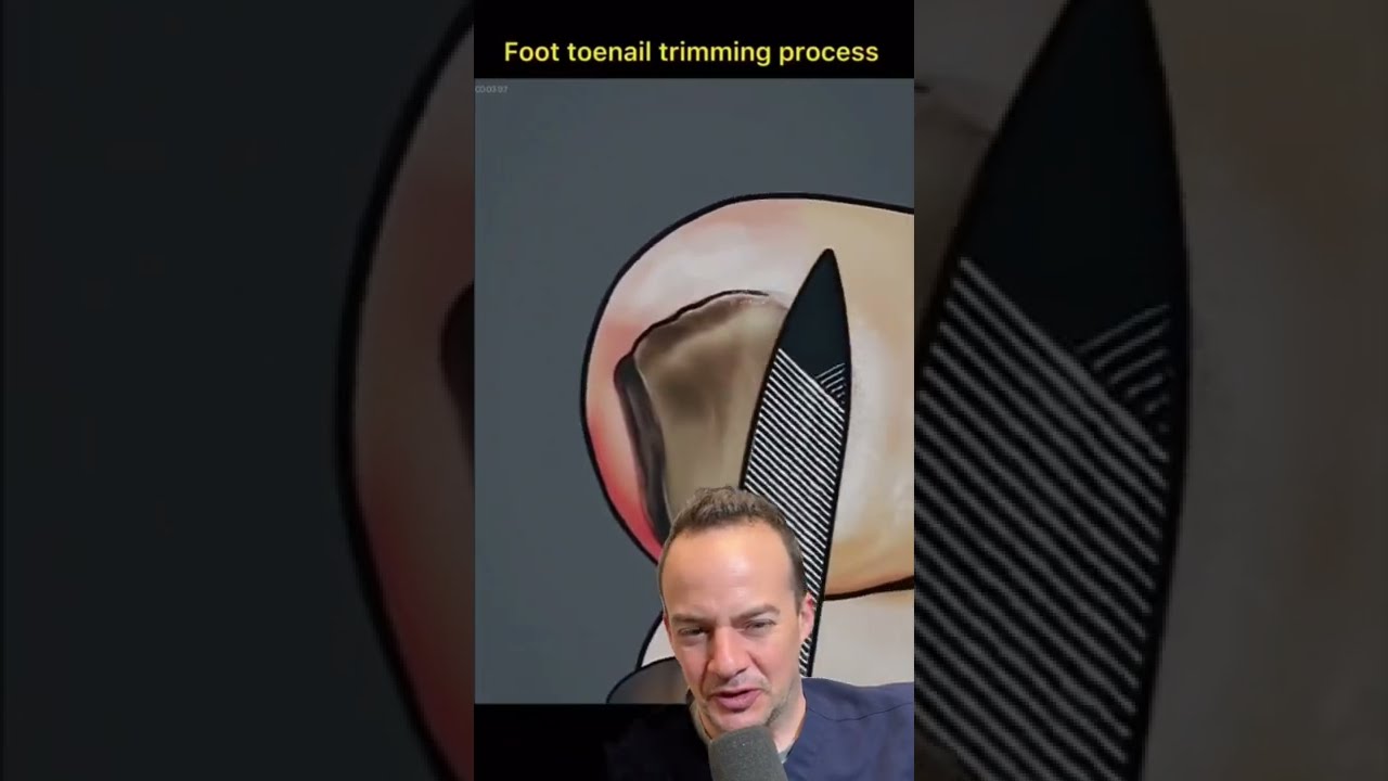 HOW TO CUT THICK TOENAILS UNREAL Shorts