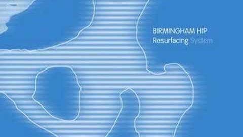 Hip Resurfacing V/S Total Hip replacement