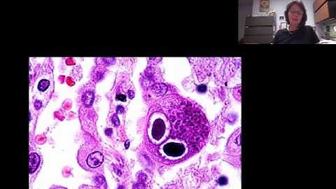 The Use of ASM Resources for Teaching Microbiology