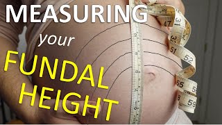 Fundal Height: Measurement, What It Means & Accuracy