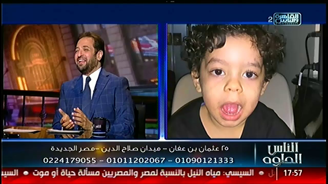 الناس الحلوة | مشاكل الحول وطرق علاجها مع د.محمد لاشين