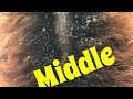 💜 Dandruff Scratching: Big Flakes Flaky Middleeee w/ CojonaJ  & Carlito Black