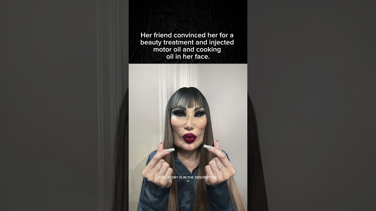 Woman's Friend Destroyed Her Face 