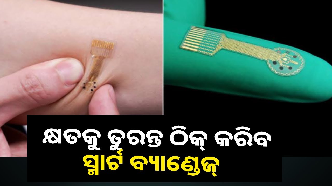 ସାଧାରଣ ବ୍ୟାଣ୍ଡେଜ ଠାରୁ ସମ୍ପୂର୍ଣ୍ଣ ଭିନ୍ନ ଏହି ବ୍ୟାଣ୍ଡେଜ୍‌, ଜାଣନ୍ତୁ କିପରି କରିବେ ବ୍ୟବହାର