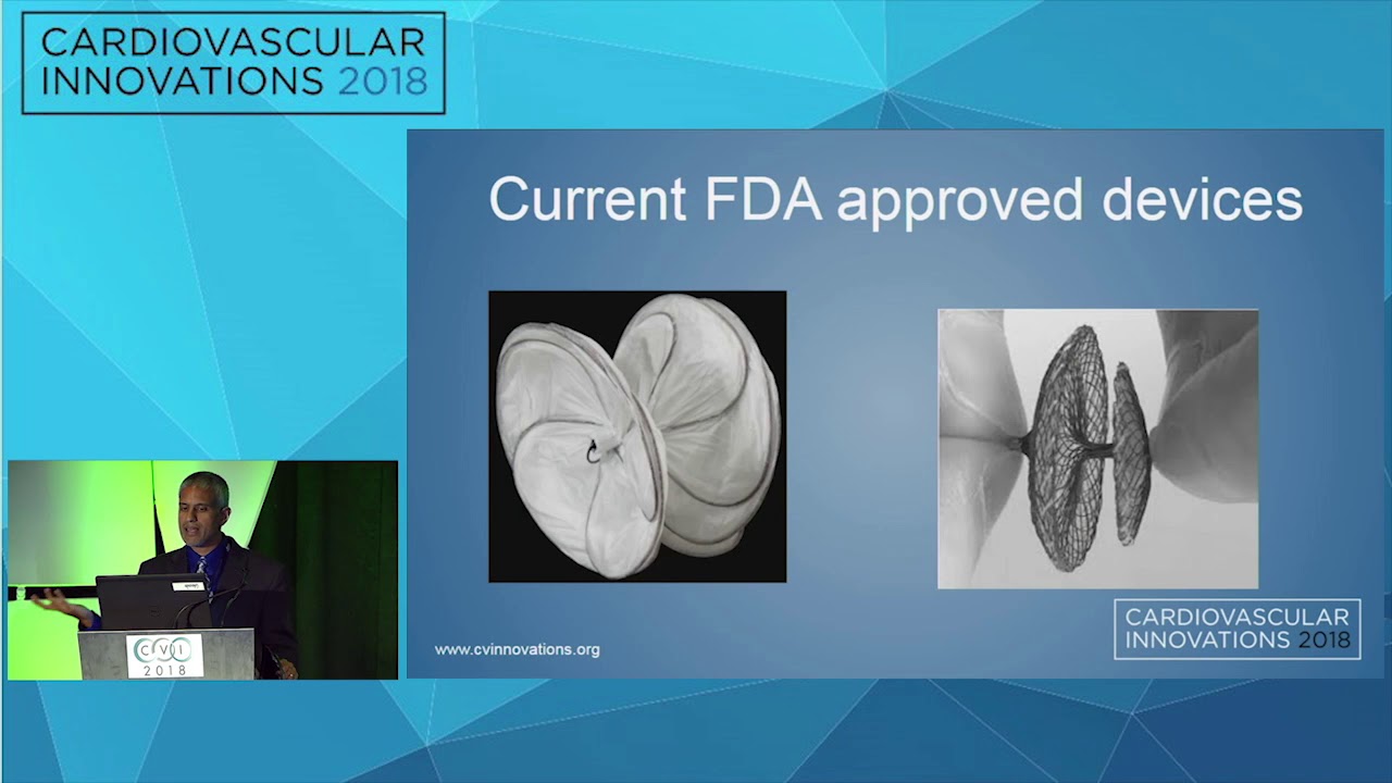 CVI2018 Session: What's missing in occluder therapy? - Srinivas Iyengar, MD interventional cardiology jobs