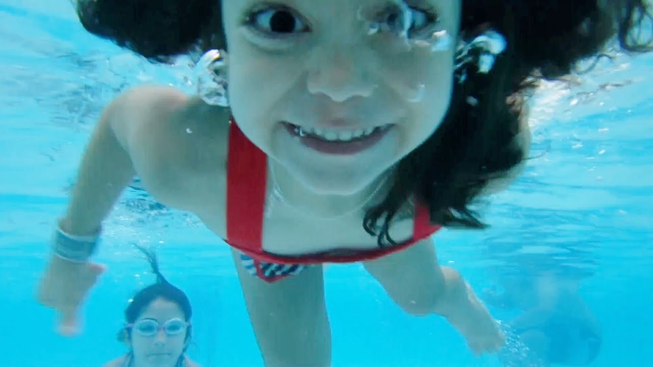 infantile systemic hyalinosis QUANDO ELA CRESCEU? - FLÁVIA CALINA