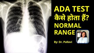 ADA Test for TB or Pleural Fluid in Hindi | Adenosine Deaminase Test