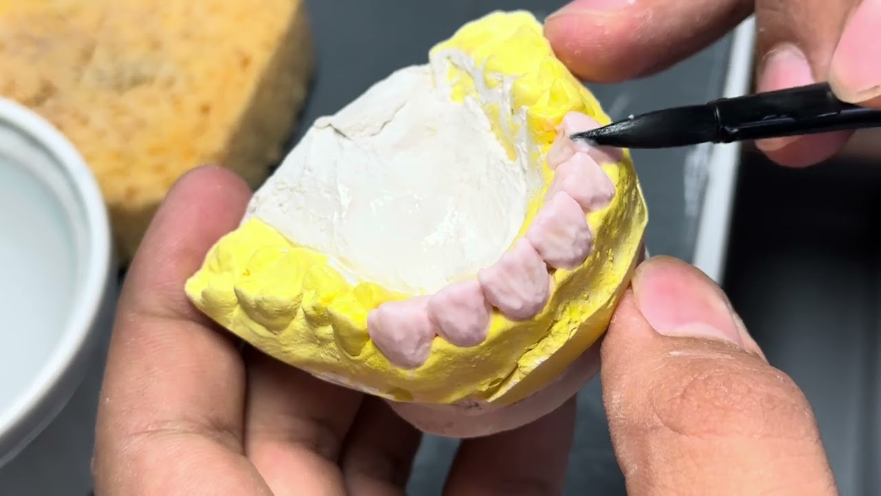 Zirkonyum Seramik 1. Pişim 🦷🖌️