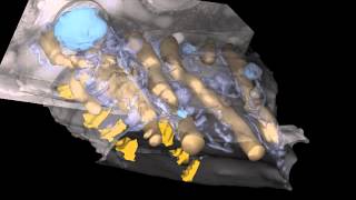 3D reconstruction of C. elegans wild type muscle