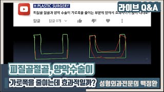 피질골절골술과 양악수술이 가로폭을 줄이는데 효과적일까?