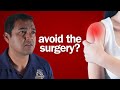 When Might it Actually Be Good to Avoid Rotator Cuff Surgery?