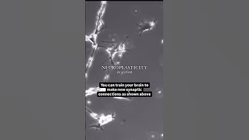 Actual footage of brain rewiring itself...neuroplasticity in action