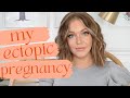 my ectopic pregnancy story | mommed