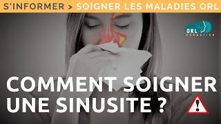 How to Treat Sinusitis? | ENT Patient Information