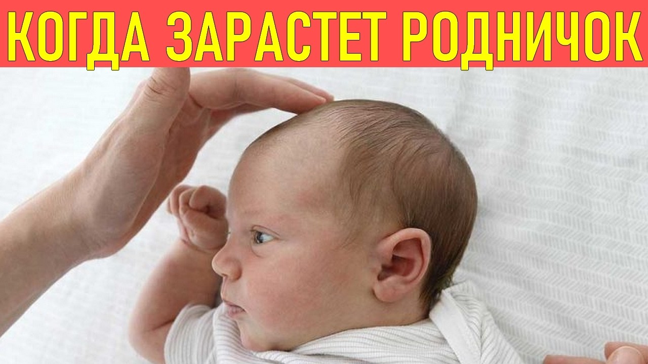 КОГДА ЗАРАСТАЕТ РОДНИЧОК У РЕБЕНКА | Важная информация для родителей