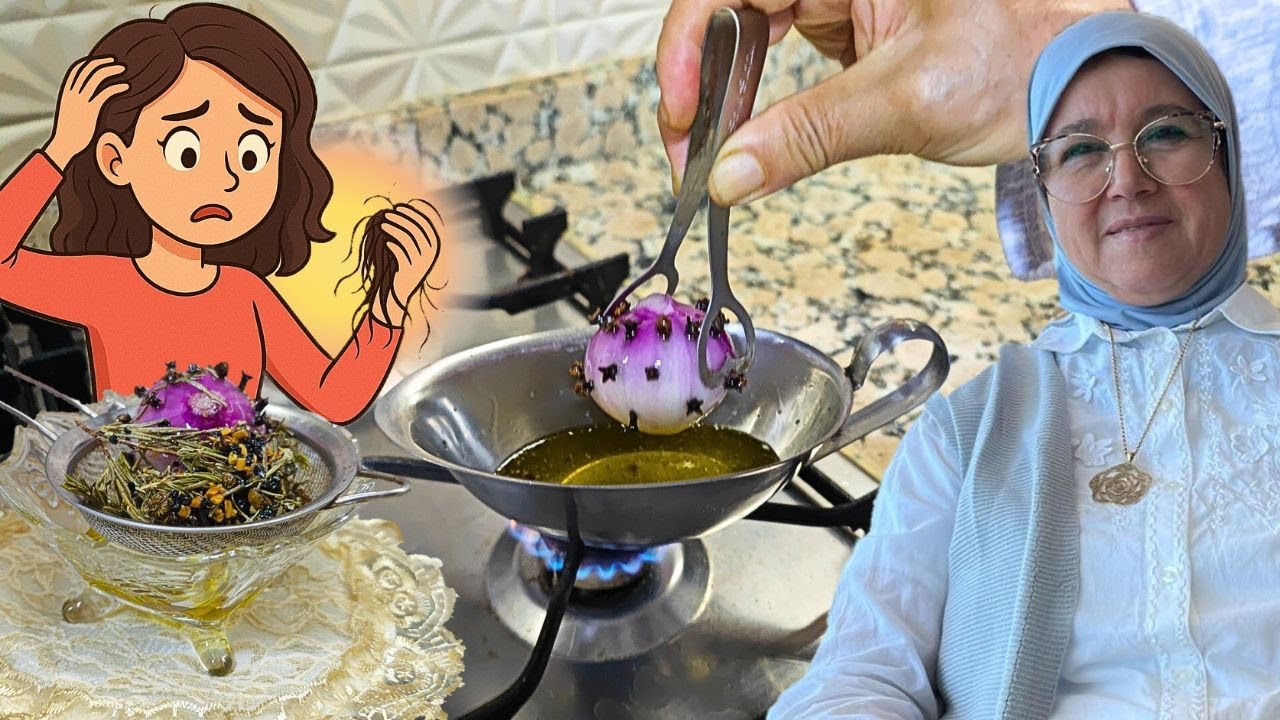 من جعبة الماضي … أقوى علاج فعال لفراغات الرأس 🔥