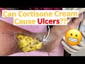 Can Cortisone Cream Cause Ulcers??