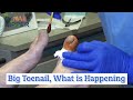 What is Dr Nail Nipper working on? Big Toenail (2020)