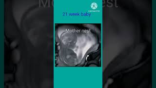 21 Week baby movement  mothers belly/fetal movementpregnancy trending