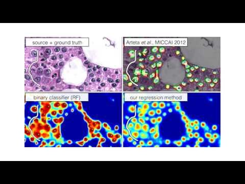 You Should Use Regression to Detect Cells [MICCAI 2015]