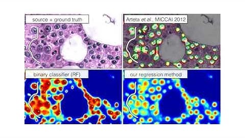 You Should Use Regression to Detect Cells [MICCAI 2015]