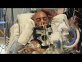 Motorcycle accident road to recovery (Brandon)
