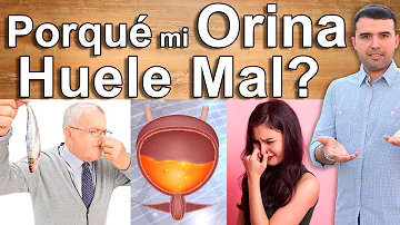 ¿Por qué mi orina es amarillenta y maloliente?