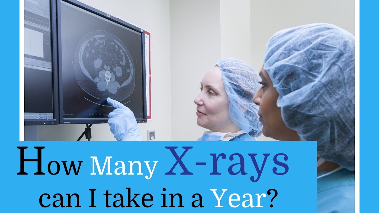 How Many X Rays Can You Have A Year