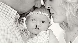 Army of Caregivers Helps Toddler Overcome Severe Birth Defects Wealth