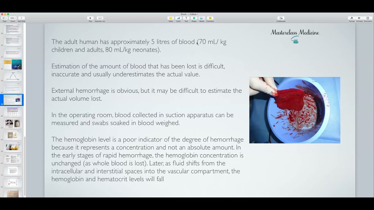 Hemorrhage - General Surgery Course (3rd Stage)