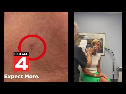 Karen Drew shares details of skin cancer scare, treatment