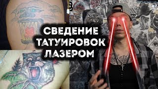 видео Удаление тату лазером. Цены на лазерное сведение татуировок в студии